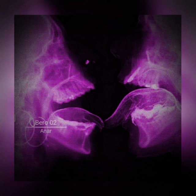 Bero 02 - Anar, Polaris